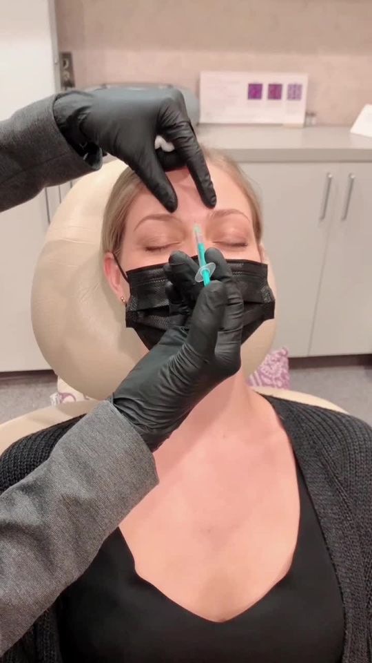 Video by Dr. Anna Petropoulos: Preventative Botox for this gorgeous girl!! 😍