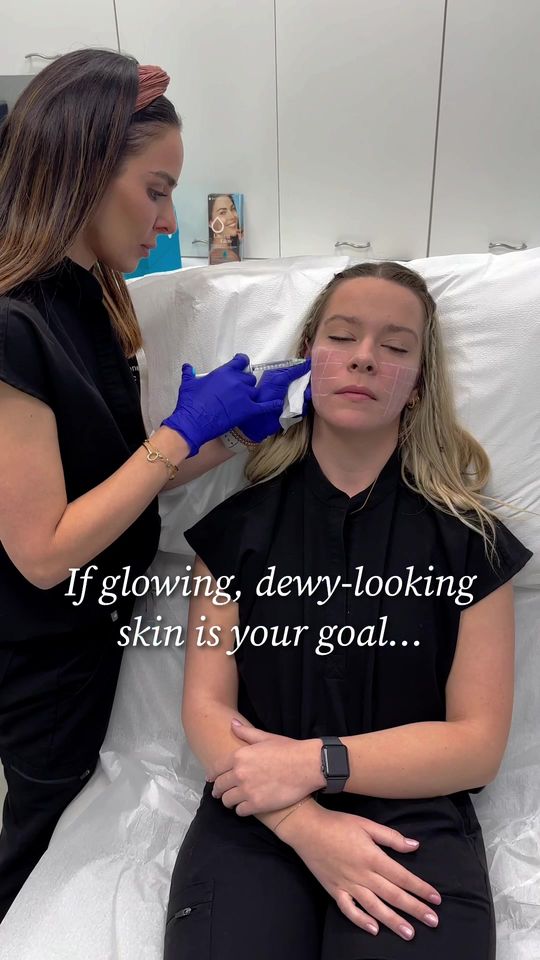 Video by Dr. Anne Hermann: SKINVIVE by Juvederm is the first in a new class of injectables. Commonly referred to as both an…