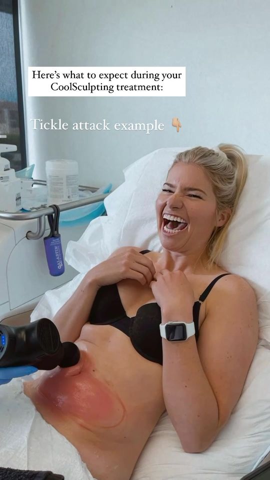 Video by Dr. Burr von Maur: What does a typical CoolSculpting visit look like you ask? Lots of laughs and tickles ❄️