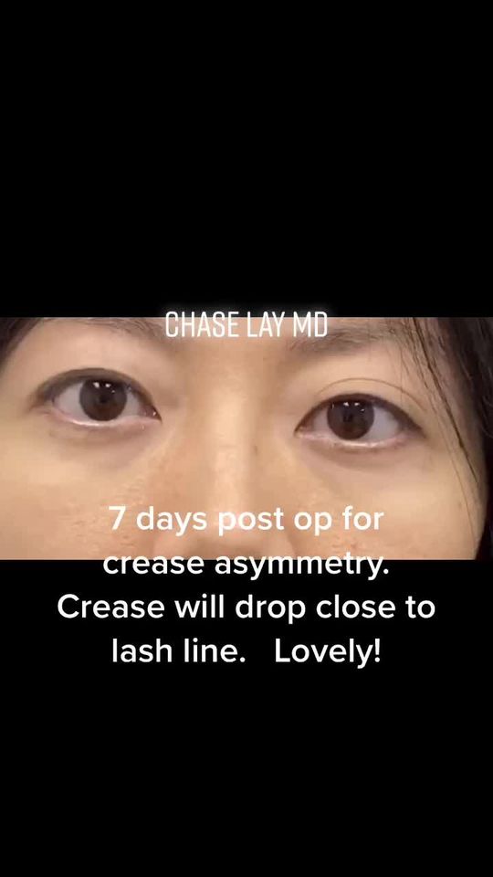 Video by Dr. Chase Lay: Video by Dr. Chase Lay