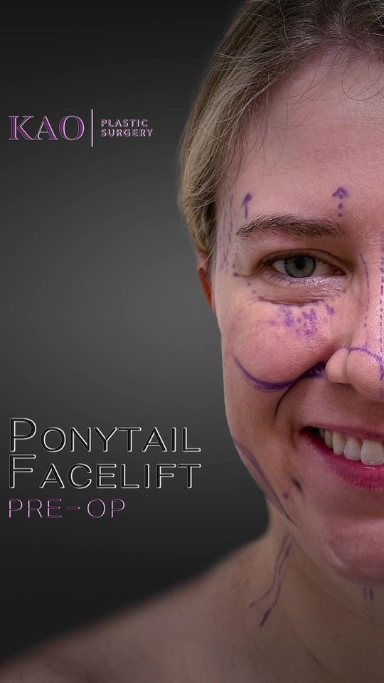 Video by Dr. Chia Chi Kao: For me, beautification is the essence of facial aesthetic rejuvenation. It all starts with pre-op…