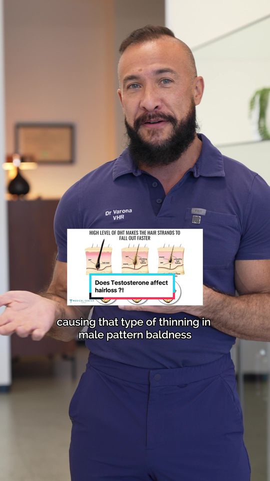 Video by Dr. Christopher Varona: Does testosterone cause hair loss?!
