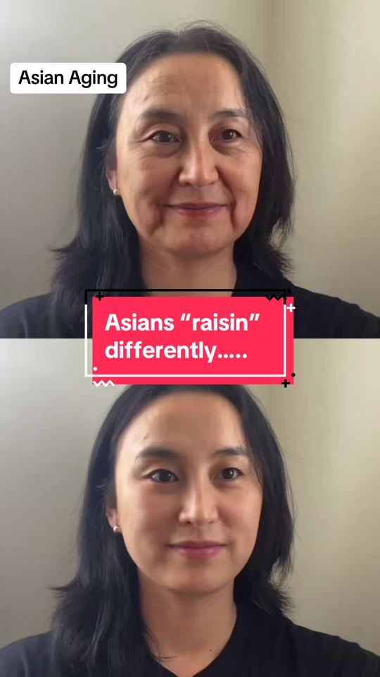 Video by Dr. Cong Ivy Ran: So.. Asians do age and some may argue even we raisin faster than caucasians. Here’s why.