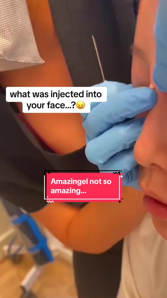Video by Dr. Cong Ivy Ran: CAUTION: Don't Get Injections from Unregulated Sources - A patient of mine recently came in seeki…