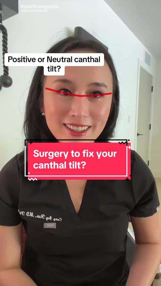 Video by Dr. Cong Ivy Ran: Canthal tilt & surgery - whether positive or negative tilt is more attractive, is based on your c…