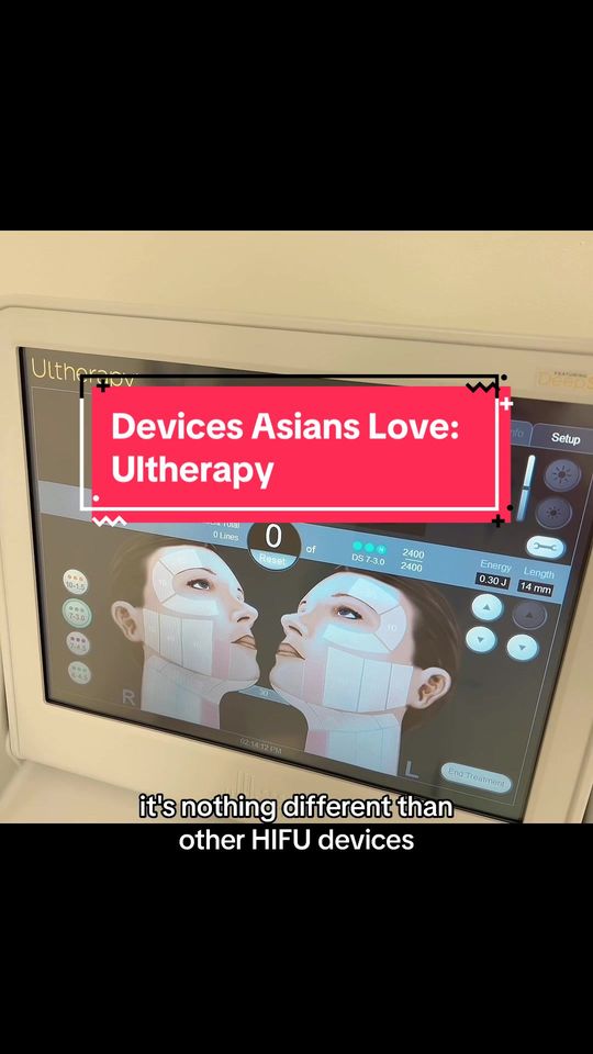 Video by Dr. Cong Ivy Ran: "✨There is magic with ultherapy~ the beloved holy grail skin treatment in Korean and all over Asi…
