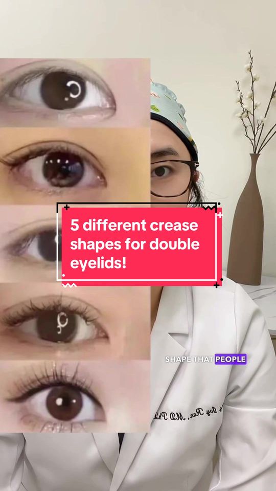 Video by Dr. Cong Ivy Ran: Did you know that not all double eyelids are the same? In fact, there are five different categori…