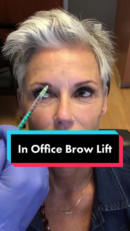 Video by Dr. David Saadat: Dysport is a versatile product that helps reduce the appearance of fine lines along with lifting…