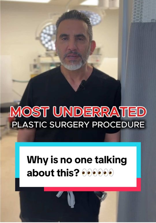 Video by Dr. David Saadat: You won’t believe how much of a difference this tiny procedure makes 👀 Upper blepharoplasty is t…