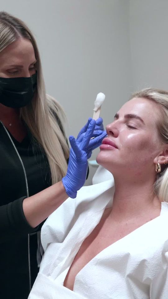 Video by Dr. Edgar Sinai Macias: VIVACE treatments help minimize fine lines and wrinkles, as well as smooth out skin tone and text…