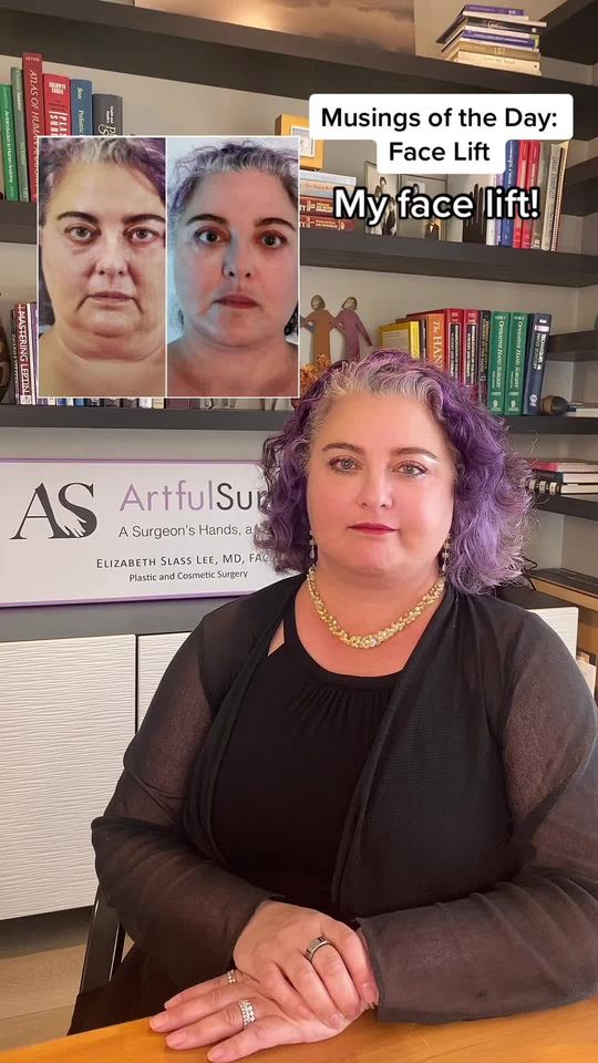 Video by Dr. Elizabeth Slass Lee: Pt. 2 Musings of the Day: Face Lift Surgery (My surgical face lift experience)✨