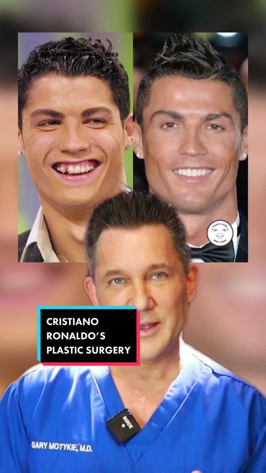Video by Dr. Gary Motykie: Has Cristiano Ronaldo had plastic surgery?