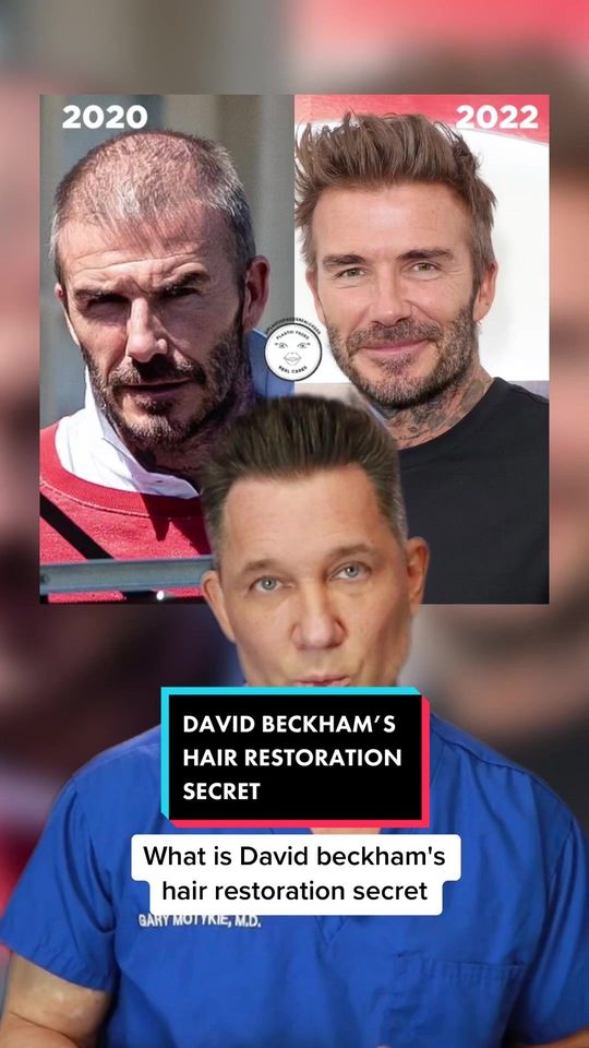 Video by Dr. Gary Motykie: What is the secret to David Beckham’s full head of hair?