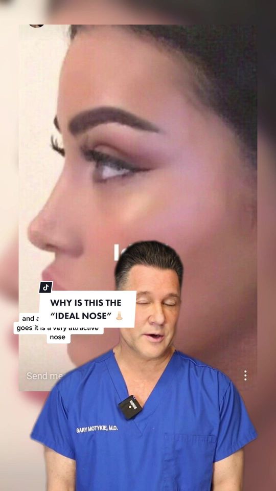 Video by Dr. Gary Motykie: Why is @wolfiecindy’s nose and face so popular in the world of plastic surgery?