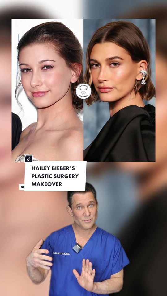 Video by Dr. Gary Motykie: Hailey Bieber’s (alleged) plastic surgery makeover ✨ What do you think?