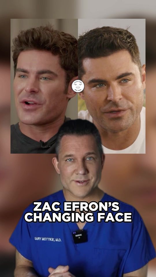 Video by Dr. Gary Motykie: Was it plastic surgery? Here is what I think about Zac’s recent transformation 🤔
