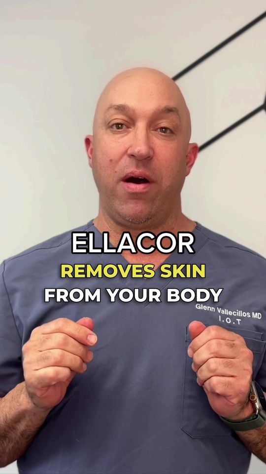 Video by Dr. Glenn Vallecillos: Introducing Ellacor, ground breaking technology that removes excess skin and reduces the appearan…