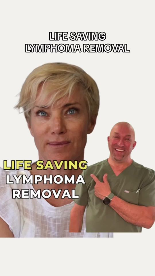 Video by Dr. Glenn Vallecillos: Our lovely patient recently went under a life saving lymphoma removal and shares her experience w…