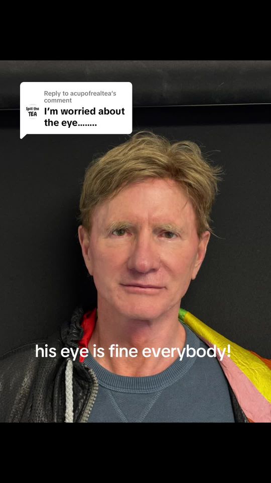 Video by Dr. Glenn Vallecillos: Replying to @acupofrealtea his eye is fine!