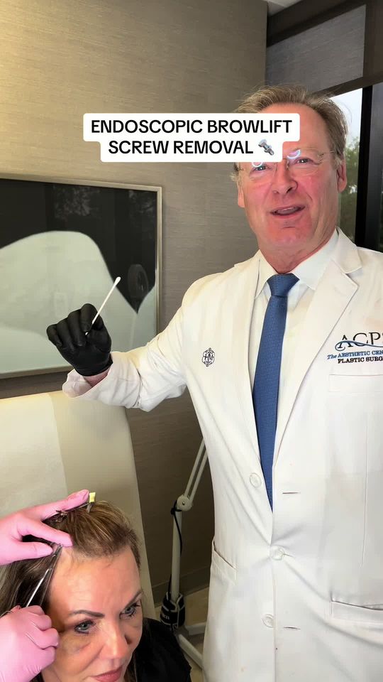Video by Dr. Henry Mentz: Endoscopic Browlift 🔩 Screw Removal 🔩 🏥 America’s First Triple Board Certified Plastic Surgeon…