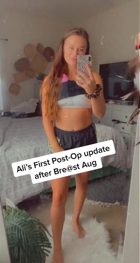 Video by Dr. Jacob Gerzenshtein: @alexandreaelaine updates us on how she’s feeling post op day 2!