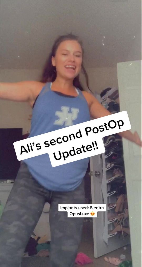 Video by Dr. Jacob Gerzenshtein: @alexandreaelaine tells us how great she’s feeling just 5 days post op!