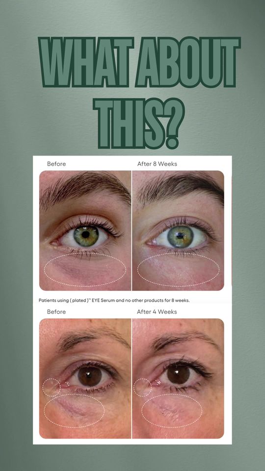 Video by Dr. Jacqueline T. Cheng: ✨ Elevate your skincare routine with Dr. J’s favorite: Plated Eye Serum! 🌟 Utilizing Plated’s ex…