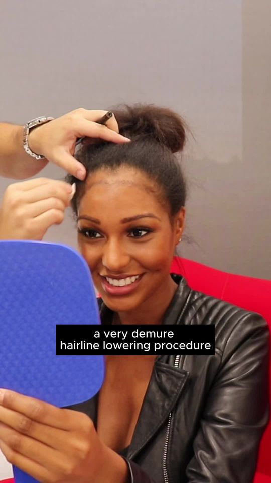 Video by Dr. Jae Pak: “Modest, Reasonable, very respectful, very demure” hairline lowering procedures are available at…