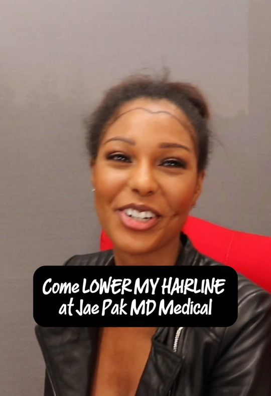 Video by Dr. Jae Pak: ✨ Framing your face just right makes all the difference! Hairline lowering with Dr. Jae Pak creat…
