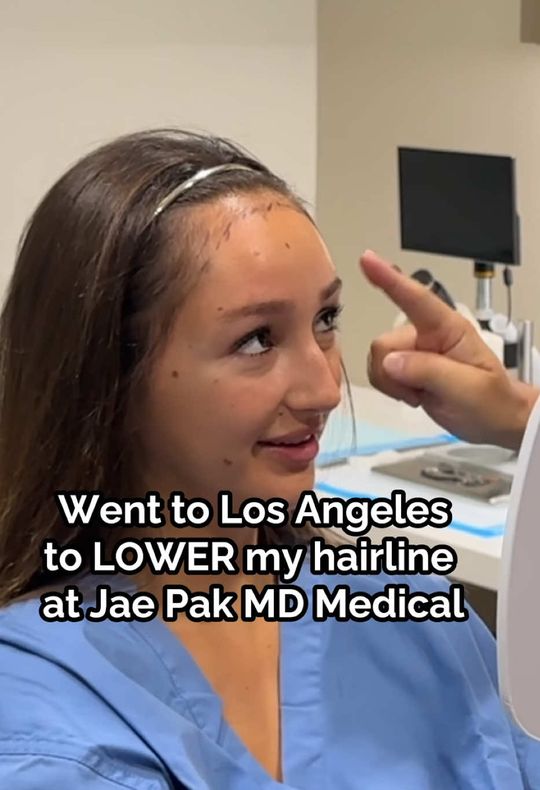 Video by Dr. Jae Pak: If loving my new hairline is illegal… then lock me up. 😌✨ Hairline lowering by Dr. Jae Pak—soft,…