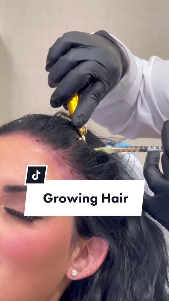 Video by Dr. James C. Marotta: This is changing the hair growth game