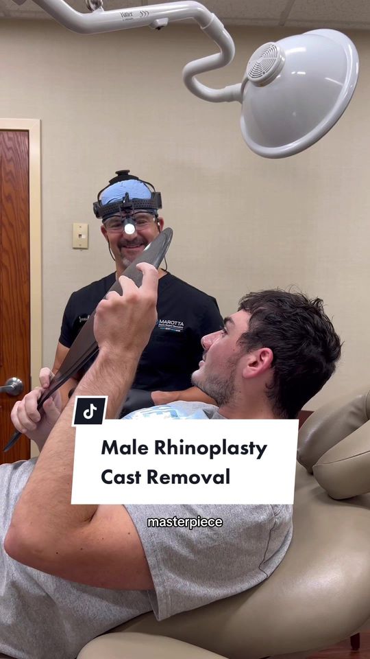 Video by Dr. James C. Marotta: Male rhinoplasty cast removal 👃