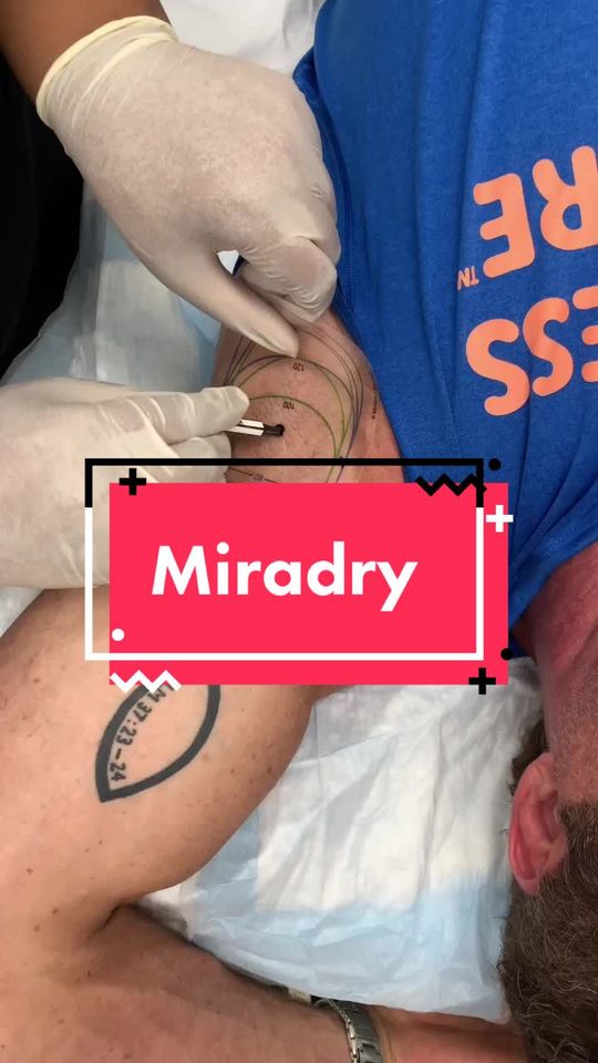 Video by Dr. Janet Allenby: 3-in-1 with Miradry💧
