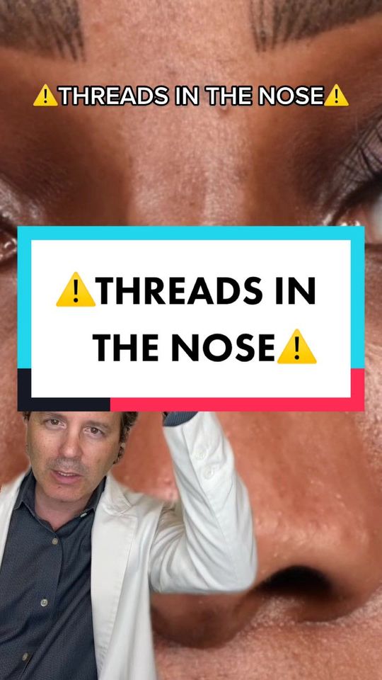 Video by Dr. Jason Litner: Have you ever thought about threads for the nose? ⚠️