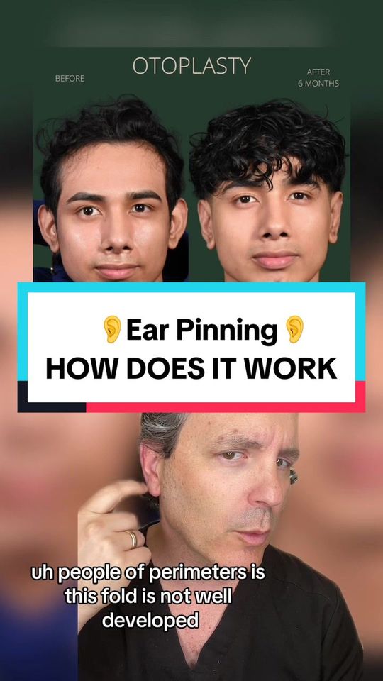 Video by Dr. Jason Litner: Video by Dr. Jason Litner