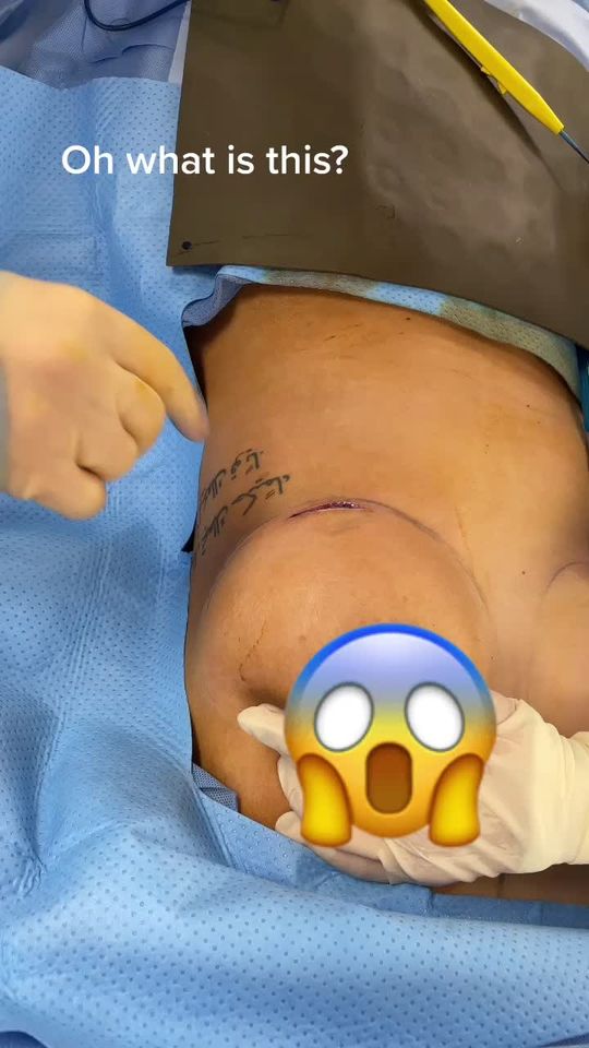 Video by Dr. Jimmy S. Firouz: Does anyone know what this is?😳