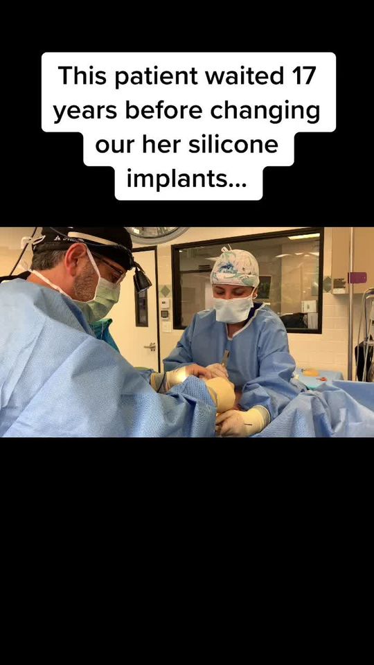 Video by Dr. Jimmy S. Firouz: Finding a 17 year old ruptured implant in the operating room!