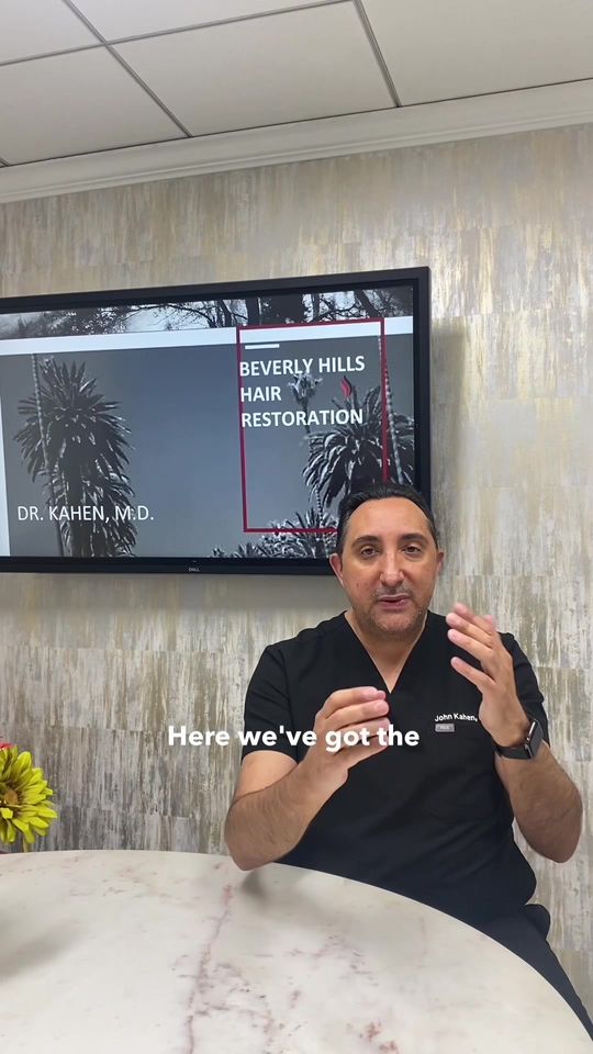 Video by Dr. John Kahen: @Corey O’Brien shared his hair transplant experience & we are so happy you love your results! 💯