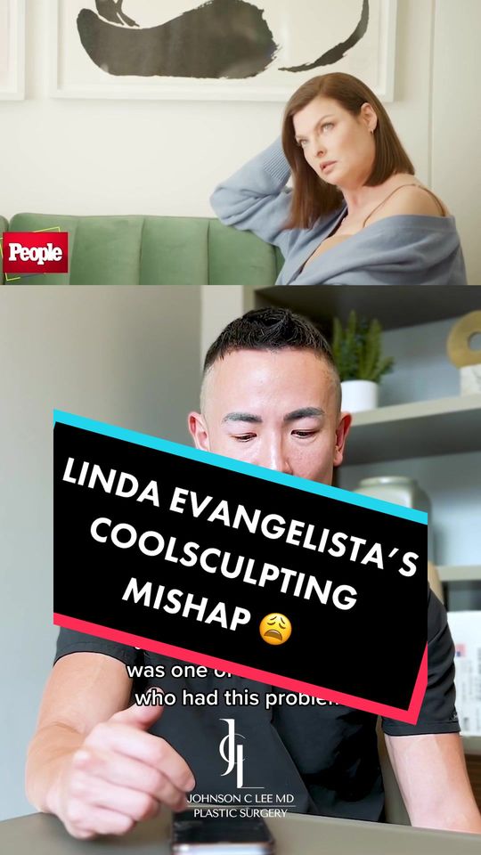 Video by Dr. Johnson C. Lee: The Rare Side Effect of Coolsculpting: Paradoxical Adipose Hyperplasia It's no secret that Linda…