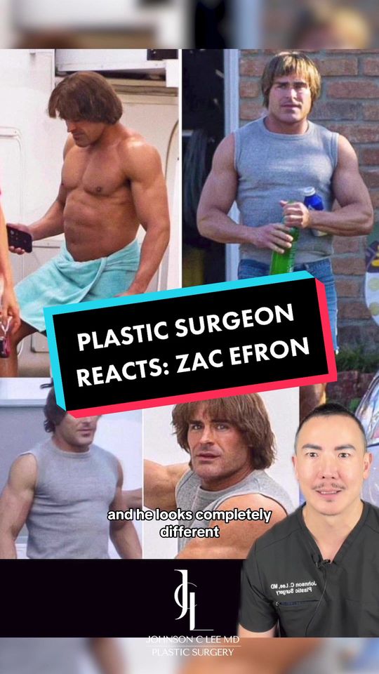 Video by Dr. Johnson C. Lee: Zac Efron's Transformation: Real Gains or Plastic Enhancements? I'm absolutely floored by Zac Efr…