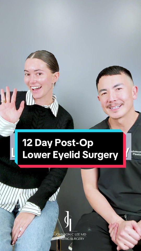 Video by Dr. Johnson C. Lee: @Madeleine White had lower eye surgery with me 12 days ago and is healing BEAUTIFULLY. Eye bags c…