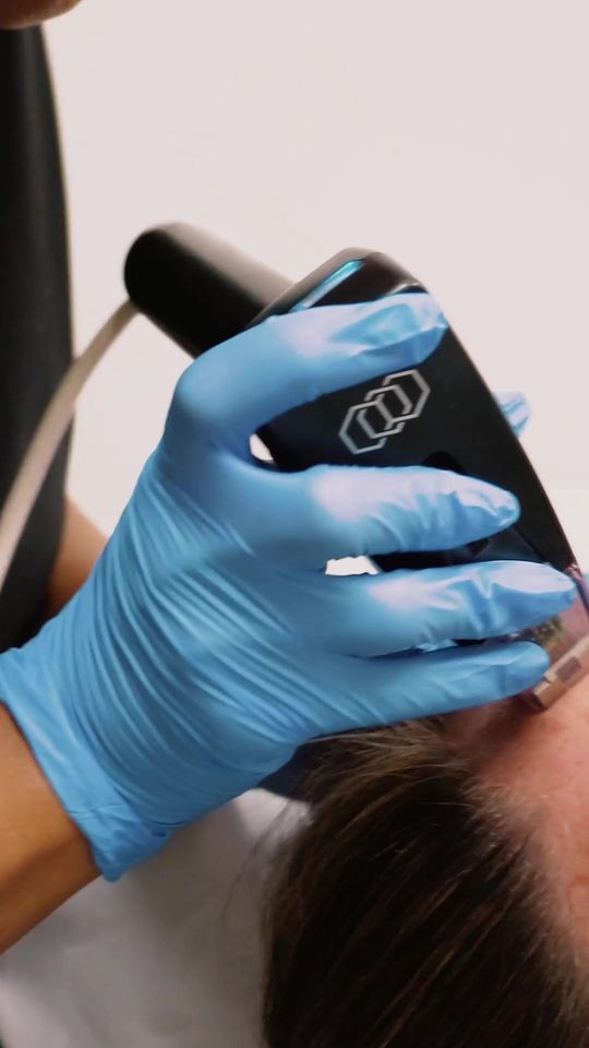 Video by Dr. Jordan Cain: With the power of Fractional RF & Microneedling in one treatment is your go-to treatment for anti…