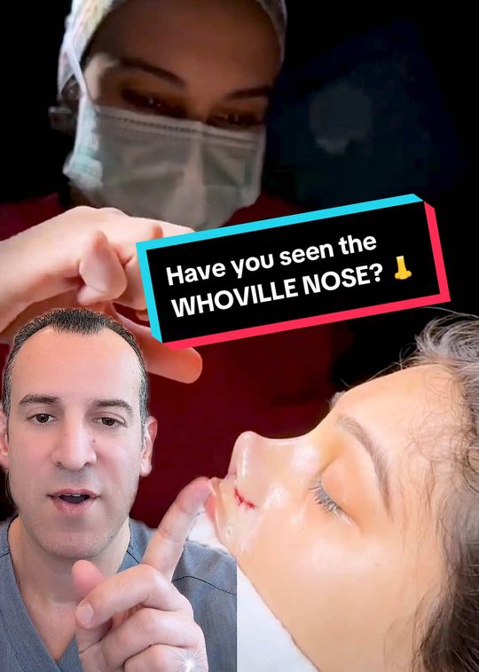 Video by Dr. Josef Hadeed: Not all rhinoplasty results are created equal. While every patient has unique goals, it’s importa…