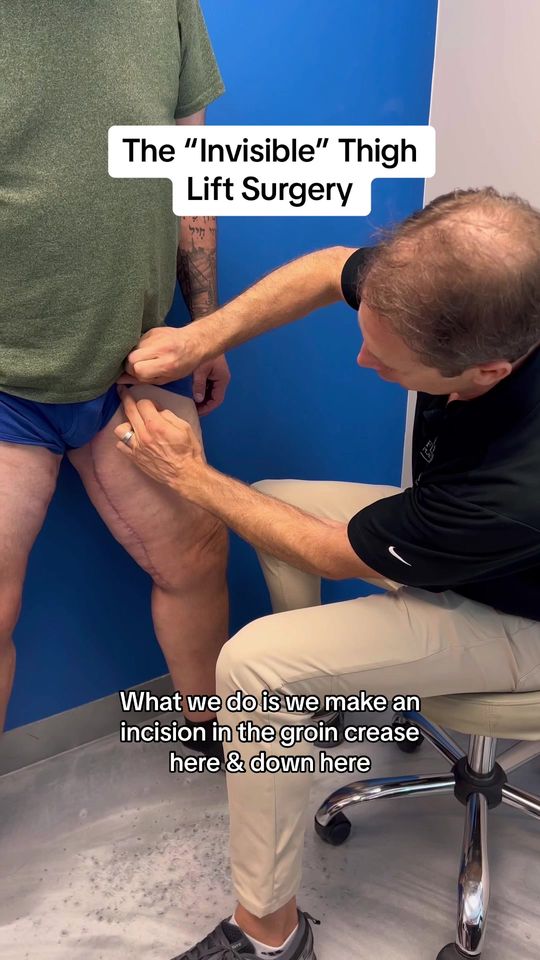Video by Dr. Joseph Parks: Our plastic surgeons specialize in taking care of patients that have lost a significant amount of…
