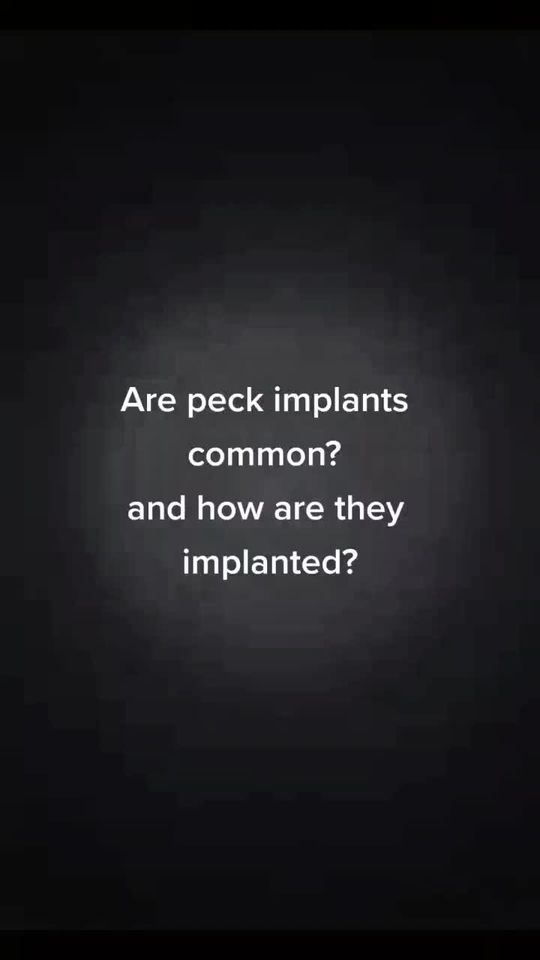 Video by Dr. Joseph Yadegar: peck implants and how they are implanted as well as the risk factors.