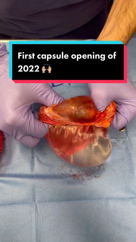 Video by Dr. Joshua Lampert: Welcome to the first capsule opening of the year! What’s inside? 👀
