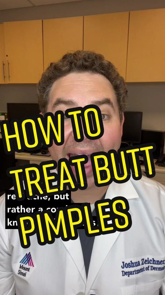 Video by Dr. Joshua Zeichner: How to treat butt pimples