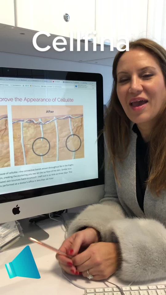 Video by Dr. Justin Yovino: Say “bye bye” to Cellulite with Cellfina!