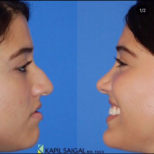 Video by Dr. Kapil Saigal: Video by Dr. Kapil Saigal