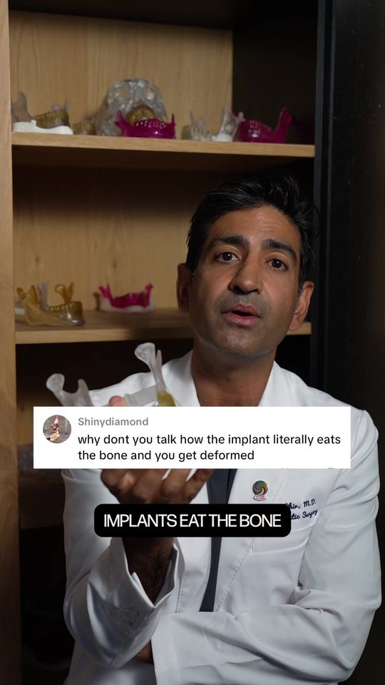 Video by Dr. Karan Dhir: 💬 One of the most common questions I get about jaw implants is: “Do they eat away at the bone?”…
